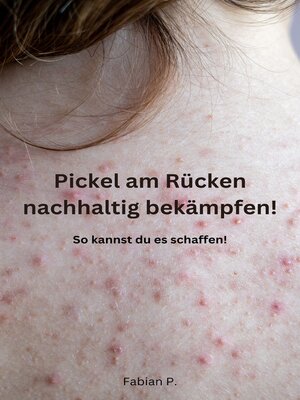 cover image of Pickel am Rücken nachhaltig bekämpfen!